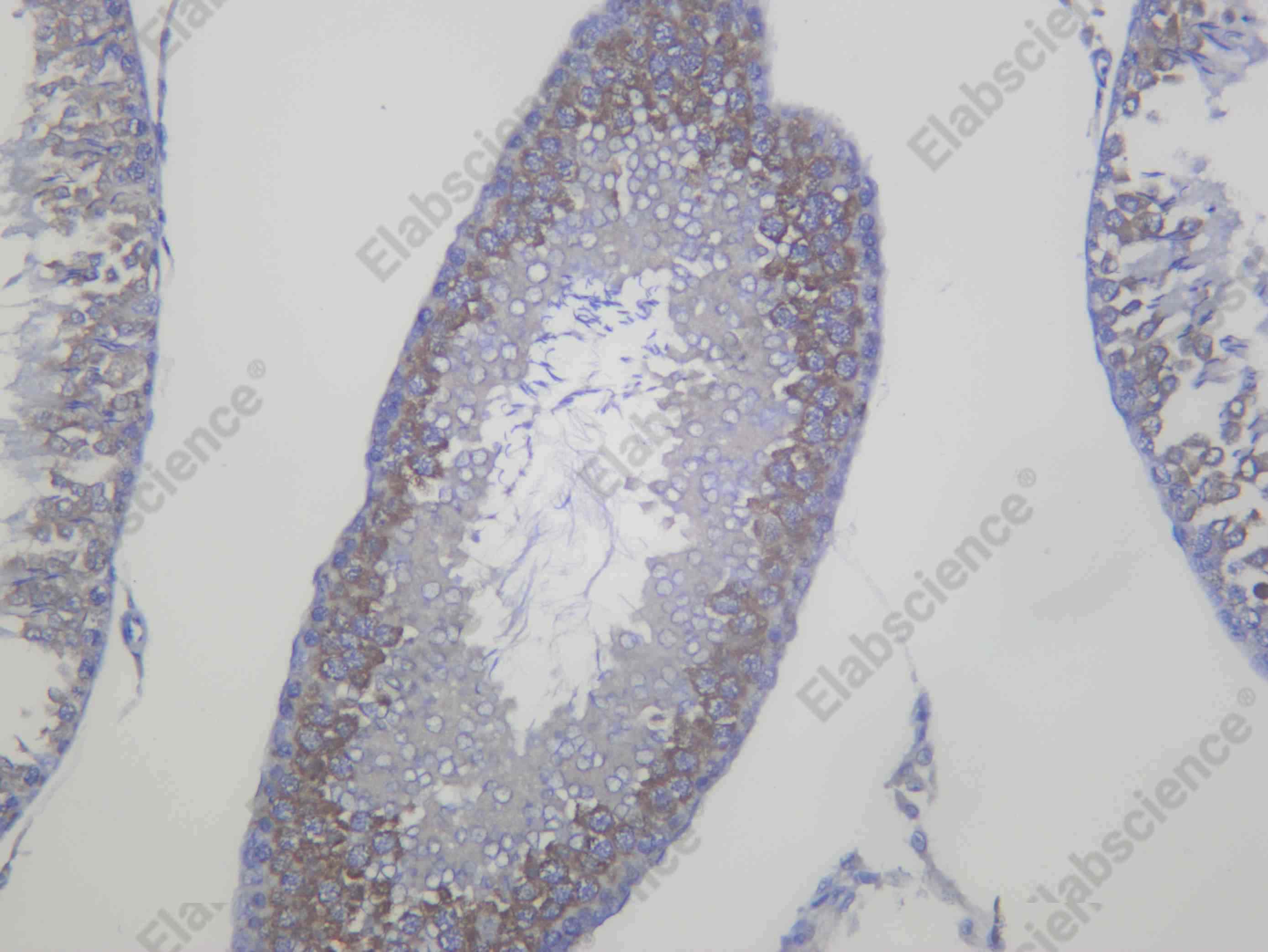 Recombinant TIP49A Monoclonal Antibody - 2