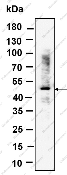 Recombinant RGS6 Monoclonal Antibody - 1