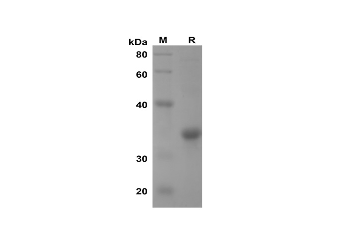 Recombinant Human IL-33 Protein(TRX Tag)-产品推荐-1