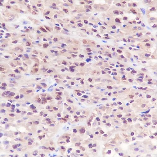 Recombinant S100A1 Monoclonal Antibody - 3