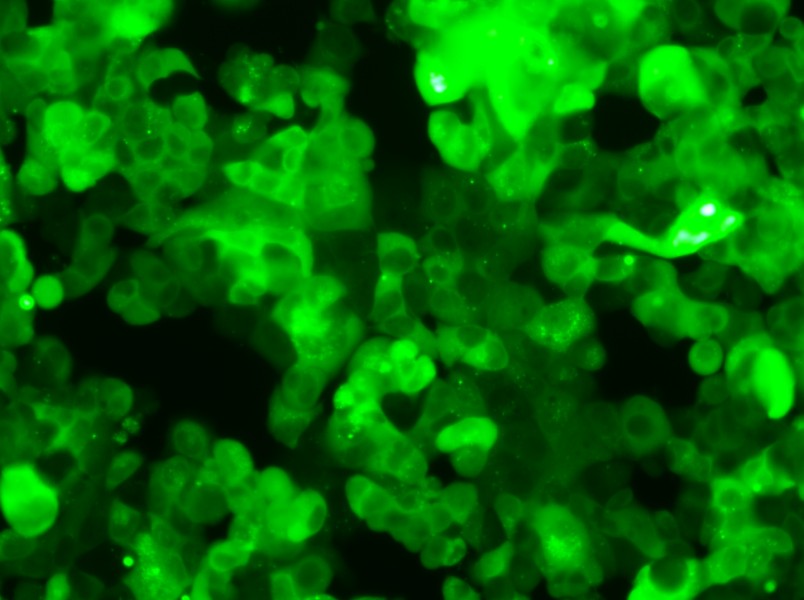 MCF-7-GFP Cell Complete Medium - 6
