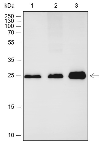 Recombinant Calbindin Monoclonal Antibody - small - 1