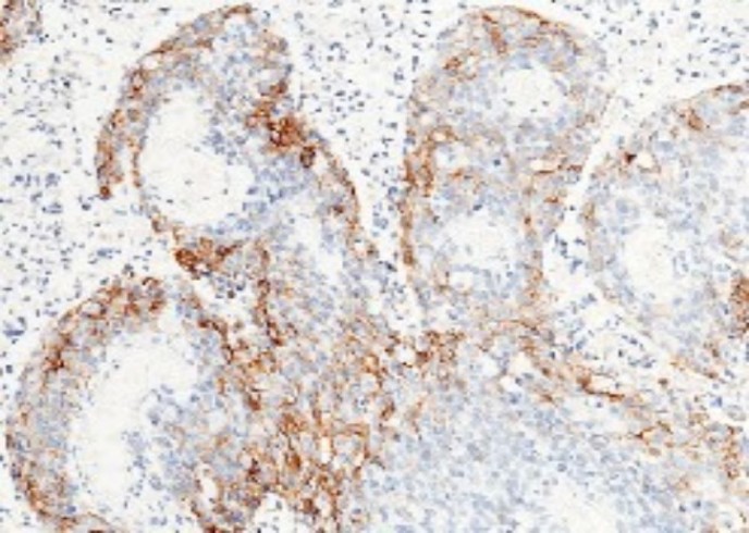 Recombinant Carbonic Anhydrase IX/CA9 Monoclonal Antibody - small - 3