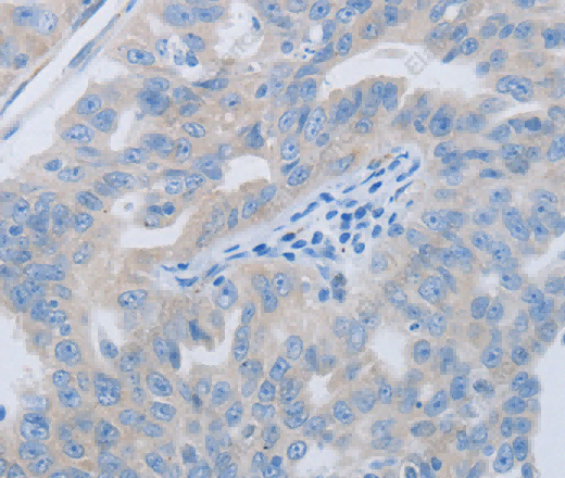 PAWR Polyclonal Antibody - 3