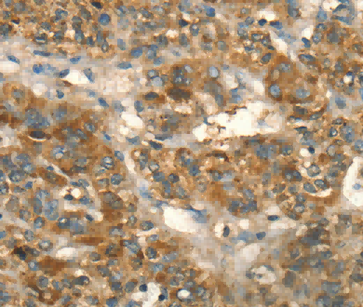 HSD17B8 Polyclonal Antibody - 2