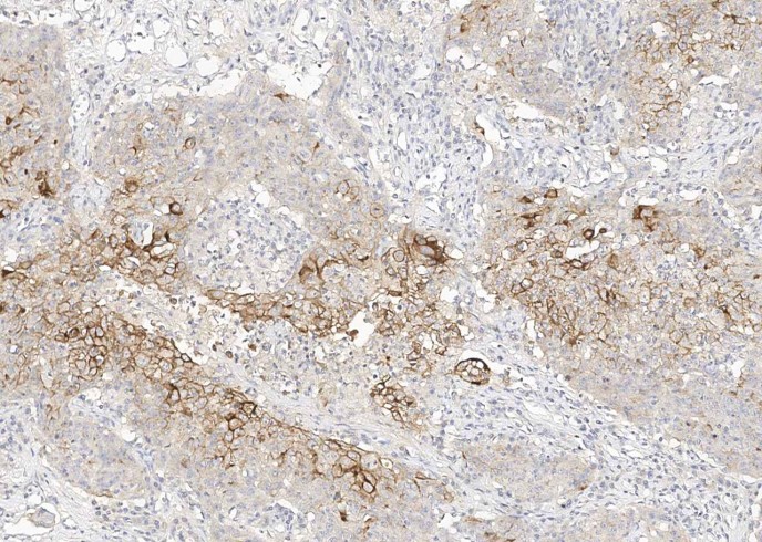 Recombinant MUC1 Monoclonal Antibody - small - 3