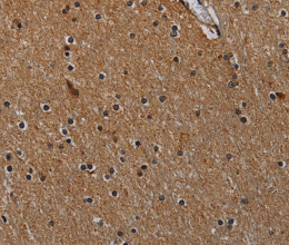 IVL Polyclonal Antibody - 3