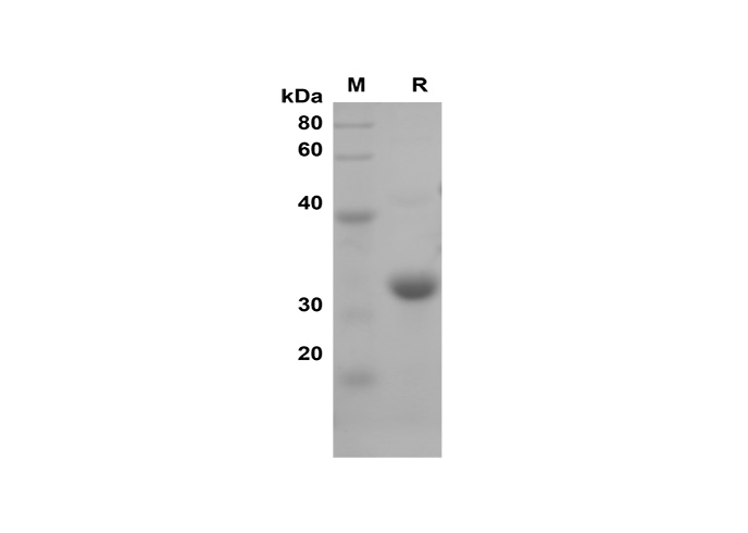 Recombinant Human CD48 Protein(His Tag)-产品推荐-1