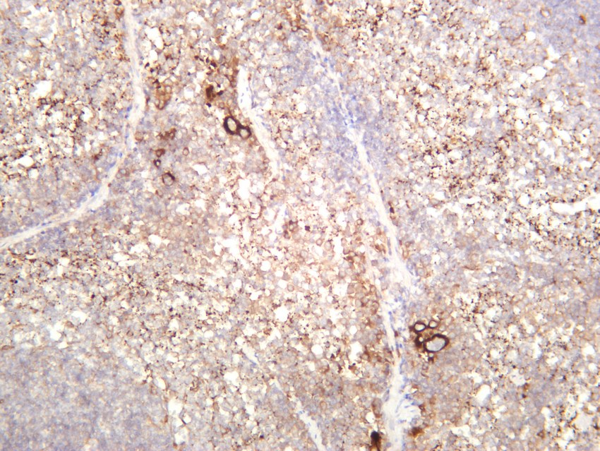 Recombinant TGF β1 Monoclonal Antibody - small - 4