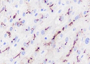 Recombinant ABCB11/BSEP Monoclonal Antibody-searchlist-1