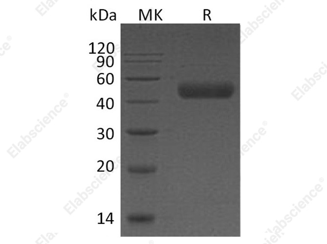 Recombinant Human Galectin 9/LGALS9 Protein (His Tag) - 1