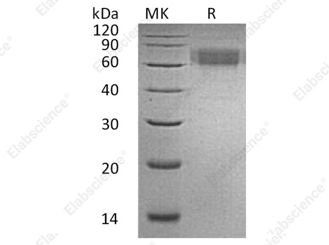 Recombinant Human IL6RA/CD126 Protein (His Tag) - 1
