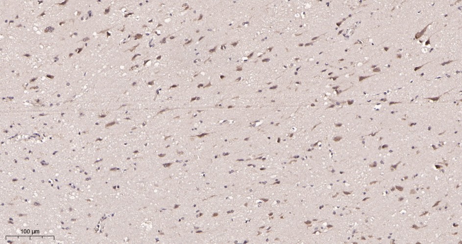 Recombinant YTHDF1 Monoclonal Antibody - small - 2