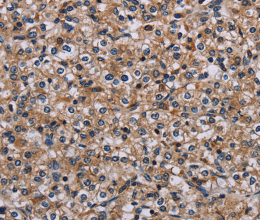 IPO4 Polyclonal Antibody - 2