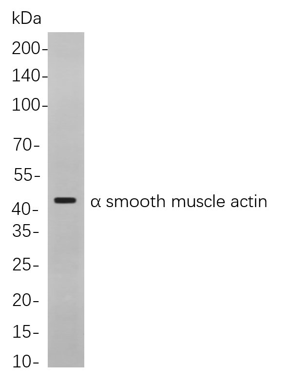 Recombinant α smooth muscle actin Monoclonal Antibody-searchlist-1