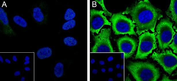 Recombinant Phospho-S6 Ribosomal Protein (Ser235, Ser236) Monoclonal Antibody-searchlist-3