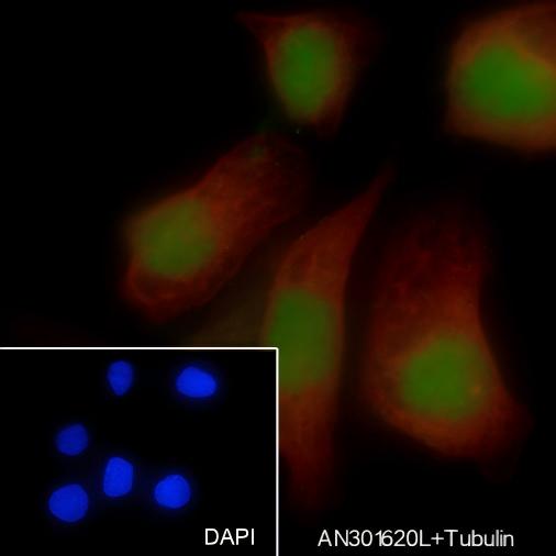 Recombinant PAX8 Monoclonal Antibody - small - 4