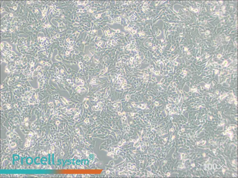 NCI-H295R Cell Complete Medium - 1