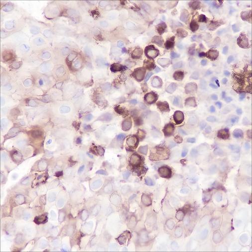 Recombinant Phospho-S6 Ribosomal Protein (Ser235, Ser236) Monoclonal Antibody - 2