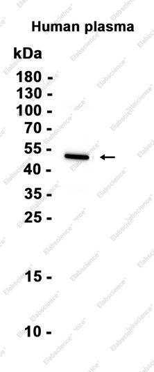 Recombinant Fibrinogen gamma chain Monoclonal Antibody - 1