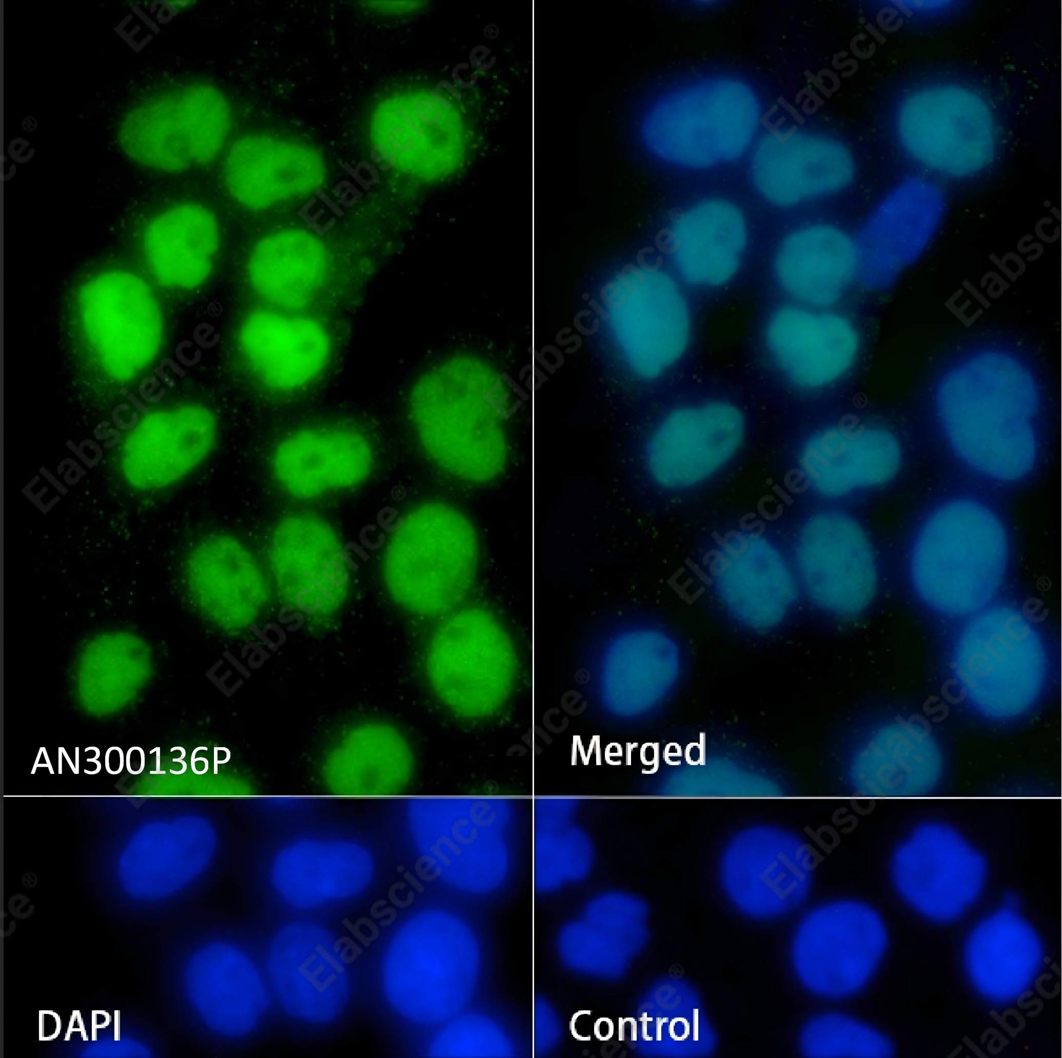 Recombinant p63(alpha) Monoclonal Antibody - 2