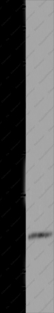 HOXD11 Polyclonal Antibody - 1