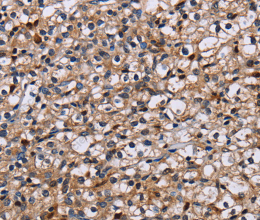 NCSTN Polyclonal Antibody - 3