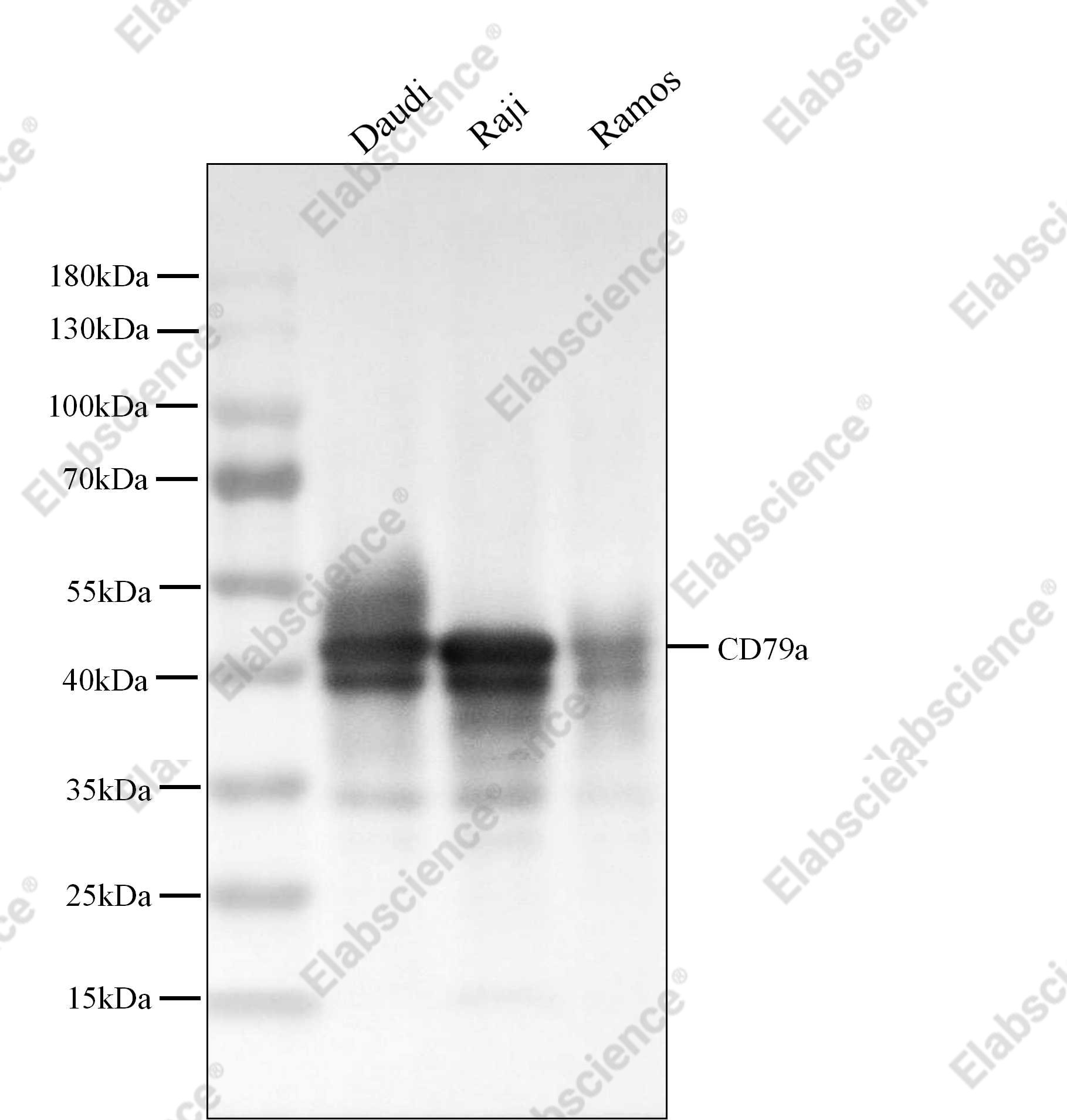 Recombinant CD79A/Ig-alpha Monoclonal Antibody - 2