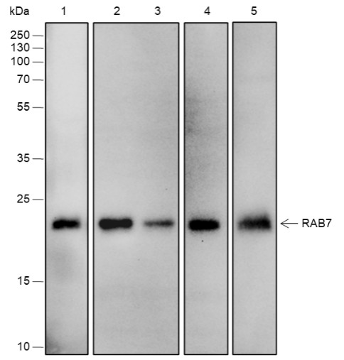 Recombinant Rab7 Monoclonal Antibody - small - 4