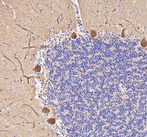 Recombinant Calbindin Monoclonal Antibody-searchlist-2
