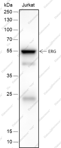 Recombinant ERG Monoclonal Antibody - 1