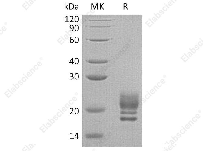 Recombinant Human COQ7 Protein (His Tag) - 1