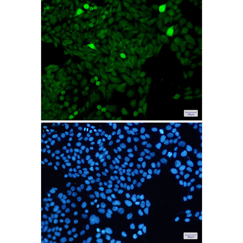 Recombinant Phospho-Histone H3 (Ser28) Monoclonal Antibody - 3