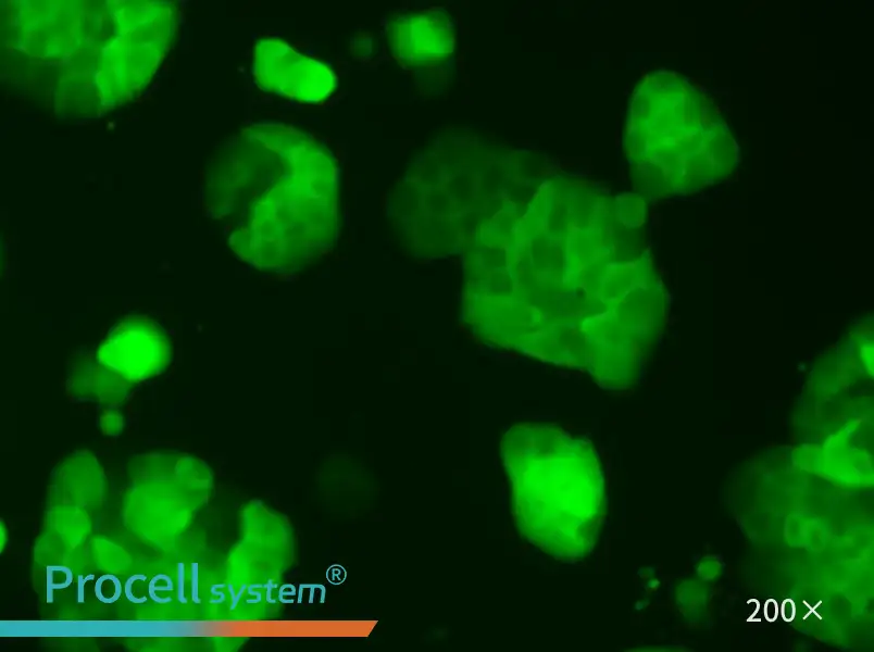 HT-29-GFP - 5
