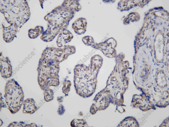 Recombinant PTTG1 Monoclonal Antibody - 1