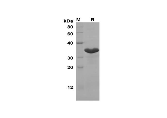 Recombinant Human CXCL9/MIG Protein(Trx Tag)-产品推荐-1
