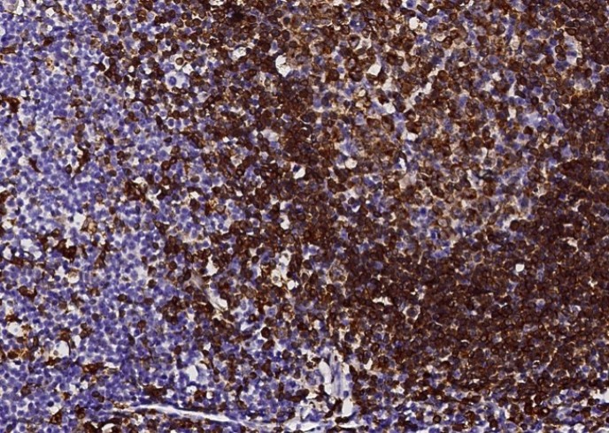 CD74 Monoclonal Antibody - small - 4