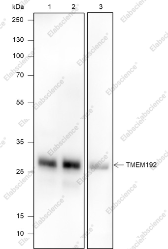 Recombinant TMEM192 Monoclonal Antibody - 1