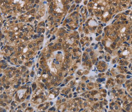 GALK1 Polyclonal Antibody - 2