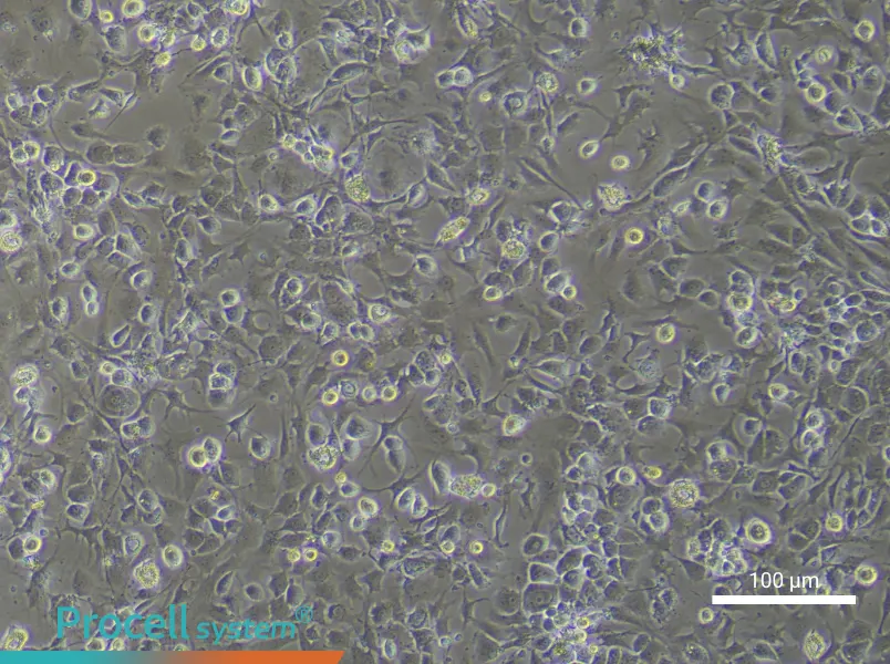 Mouse ChondrocytesMouse Chondrocytes - 2