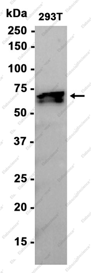 Recombinant IGF2BP2 Monoclonal Antibody - 1