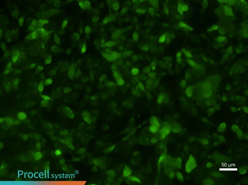 PC-3-GFPPC-3-GFP - 2