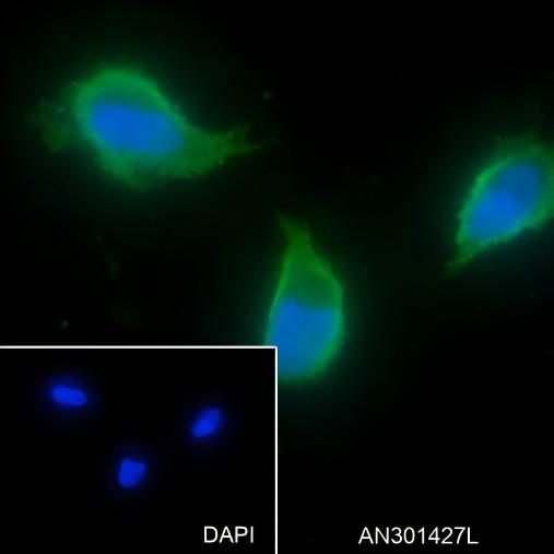 Recombinant Activin A Receptor Type IB/ALK-4 Monoclonal Antibody - 3