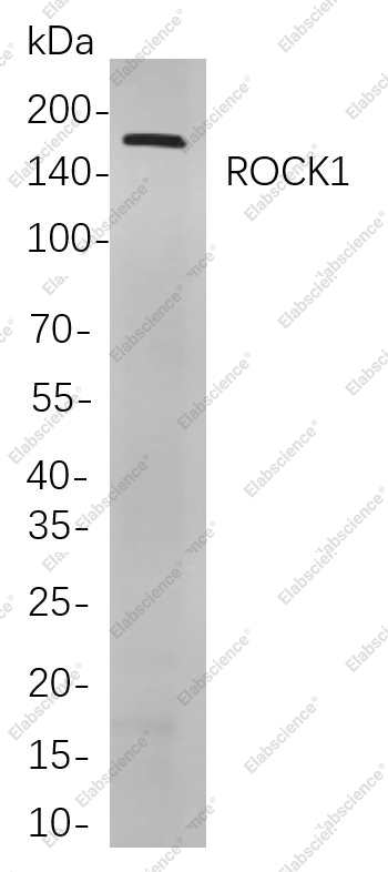 Recombinant ROCK1 Monoclonal Antibody - 1