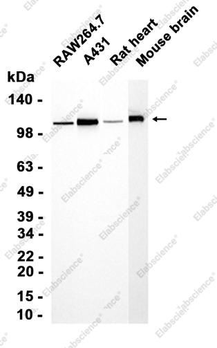 Recombinant Matrin 3 Monoclonal Antibody - 2