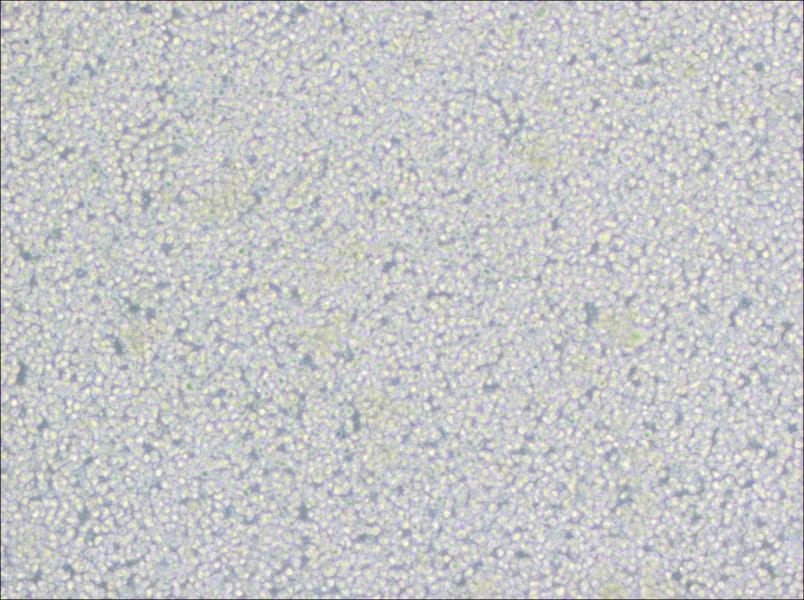 H9 [derivative of HuT 78] Cell Complete Medium-searchlist-1