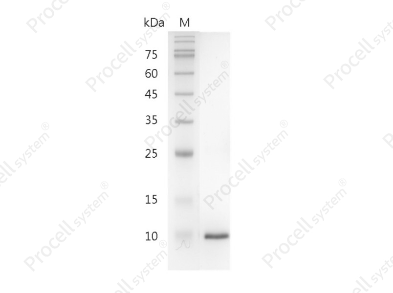 &beta;-NGF/NGF/NGFB/NGF-&beta;, Mouse, Recombinant