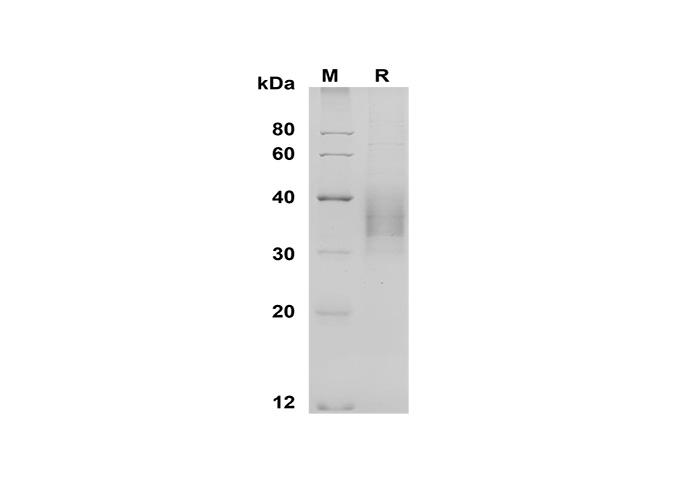 Recombinant Human CSF2 Protein-产品推荐-1