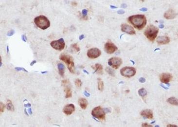 Recombinant CSDE1 Monoclonal Antibody-searchlist-2