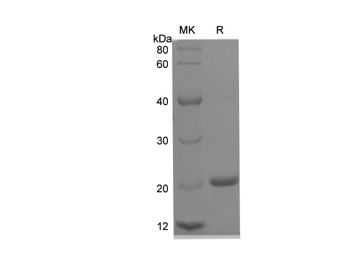 Recombinant Mouse IL2 Protein (His Tag)-1